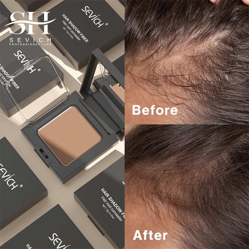 SEVICH 12g Hairline Powder Wit - Rooting Hormone Powder บทวิจารณ์และราคา