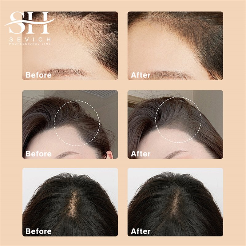 SEVICH 12g Hairline Powder Wit - Rooting Hormone Powder บทวิจารณ์และราคา