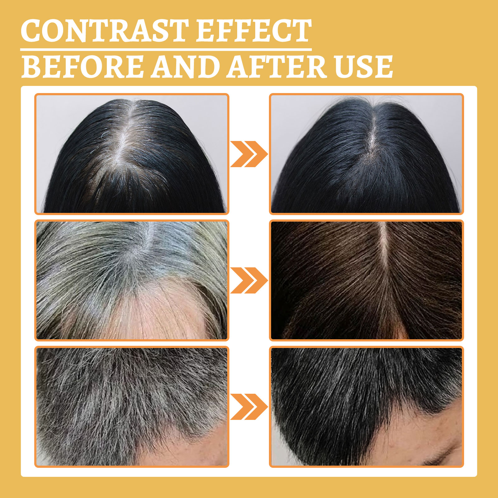 Black Ganoderma Lucidum Hair L - Root Stimulator Liquid บทวิจารณ์และราคา