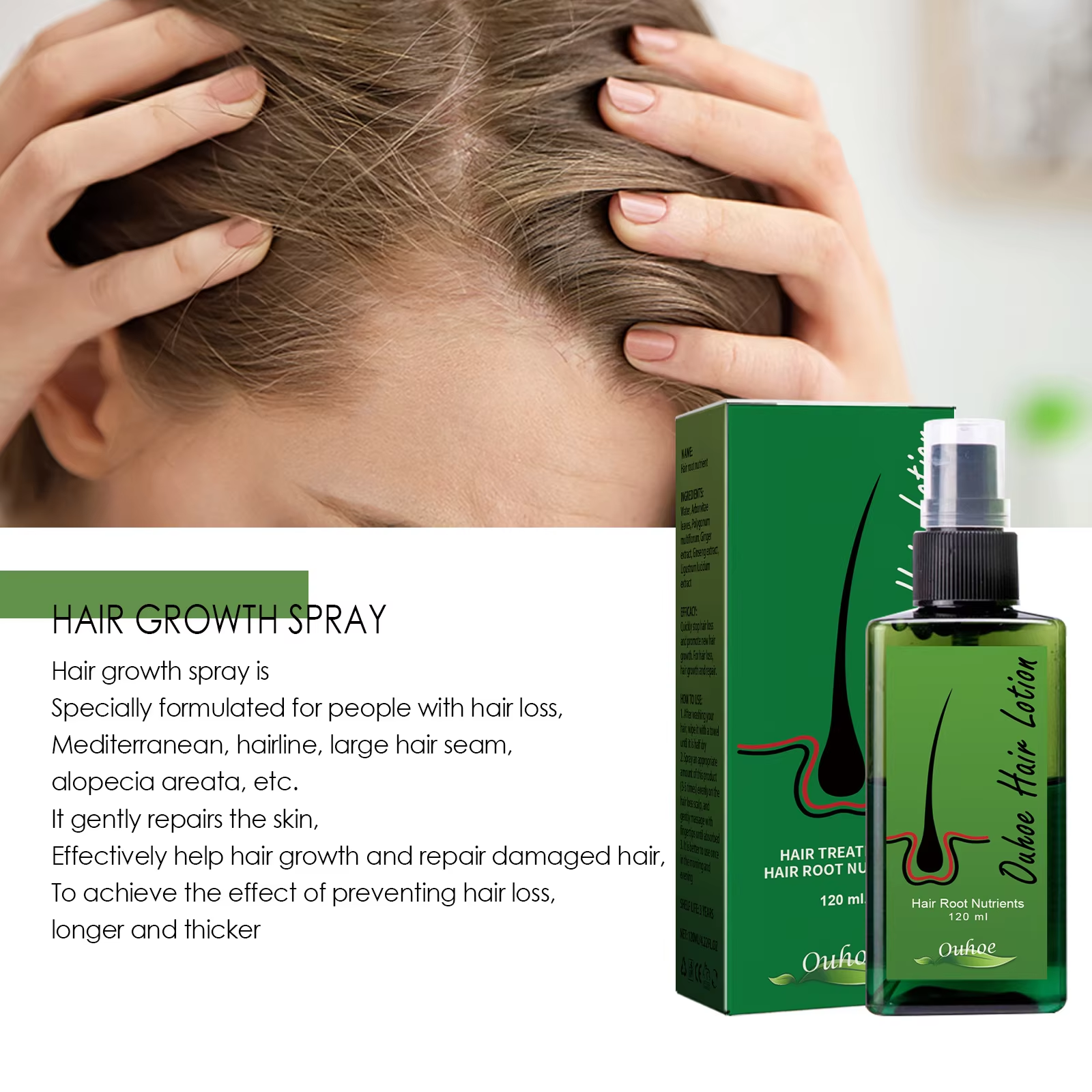 Hair Growth Spray Anti Hair Lo - Root Stimulator Liquid บทวิจารณ์และราคา